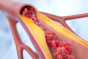 Médico vascular lista os melhores vegetais para a saúde das artérias